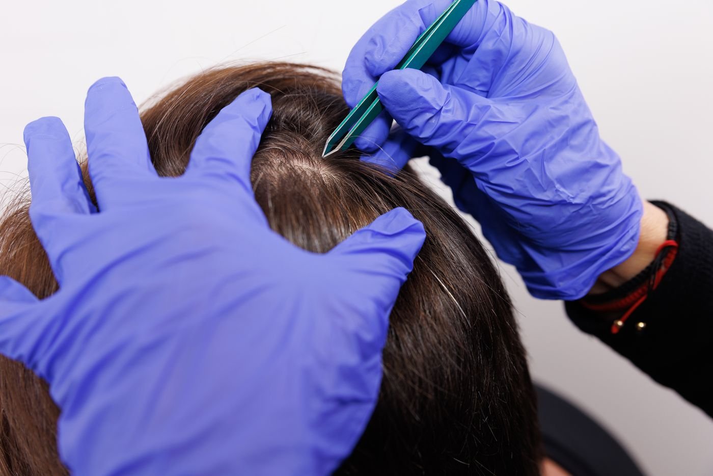 Toma de la muestra de cabello del BioScan